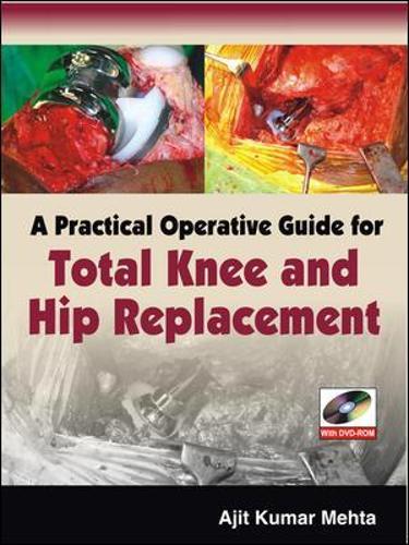 A Practical Operative Guide for Total Knee and Hip Replacement