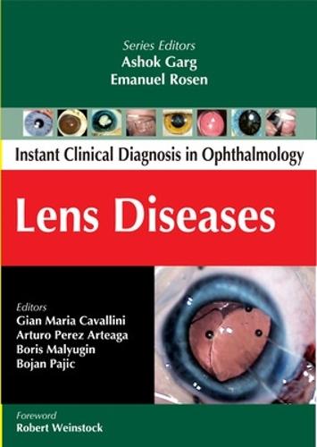 Lens Diseases