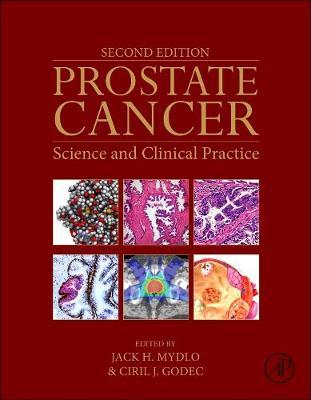 Prostate Cancer: Science and Clinical Practice