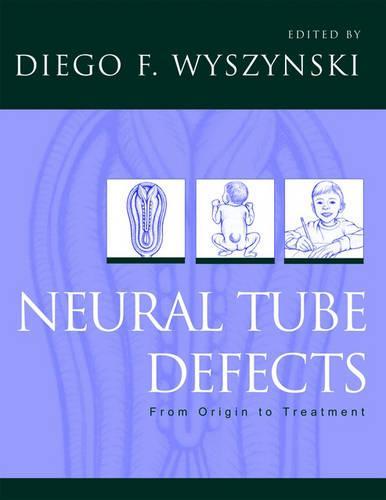 Neural Tube Defects: From origin to treatment