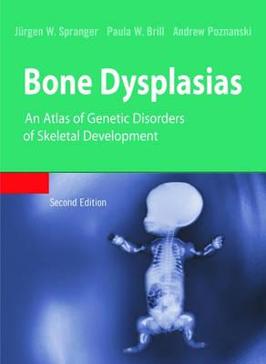 Bone Dysplasias: An Atlas of Genetic Disorders of Skeletal Development
