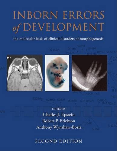Inborn Errors of Development: The Molecular Basis of Clinical Disorders of Morphogenesis