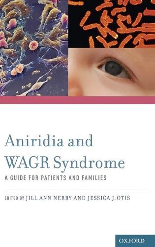 Aniridia and WAGR Syndrome: A Guide for Patients and Their Families