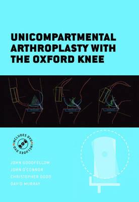 The Oxford Knee