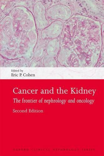 Cancer and the Kidney: The frontier of nephrology and oncology