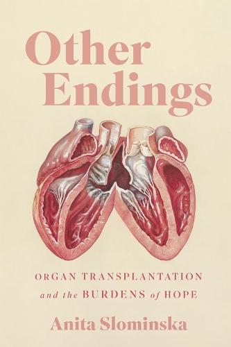 Other Endings: Organ Transplantation and the Burdens of Hope