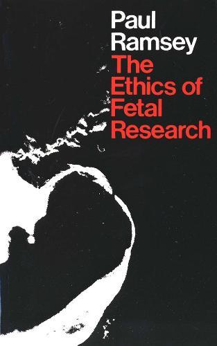 The Ethics of Fetal Research