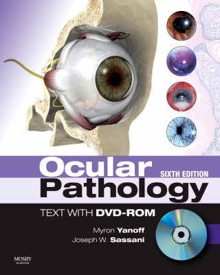Ocular Pathology: Expert Consult: Online and Print