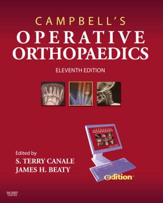 Campbell's Operative Orthopaedics E-dition: Text with Continually Updated Online Reference