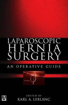 Laparoscopic Hernia Surgery: An operative guide