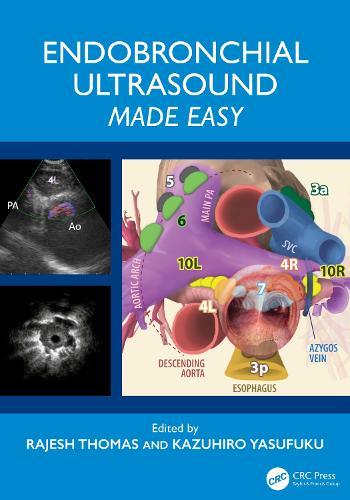 Endobronchial Ultrasound Made Easy
