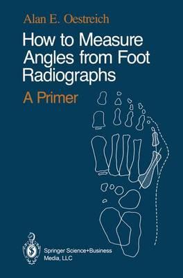 How to Measure Angles from Foot Radiographs: A Primer