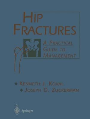 Hip Fractures: A Practical Guide to Management