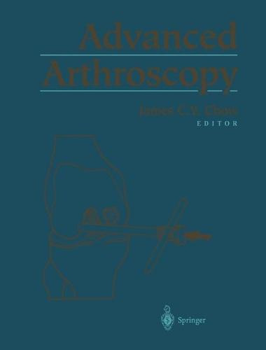 Advanced Arthroscopy