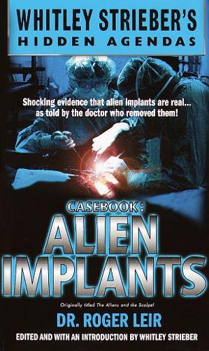 Casebook: Alien Implants