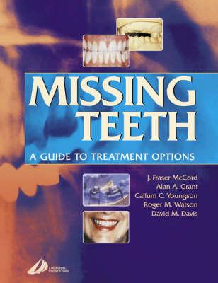 Missing Teeth: A Guide to Treatment Options