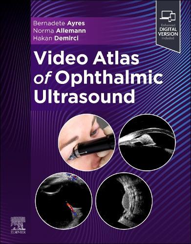 Video Atlas of Ophthalmic Ultrasound