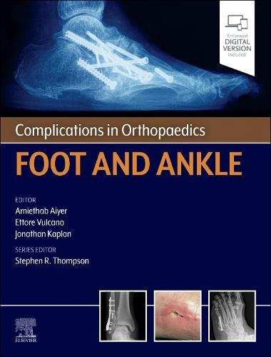 Complications in Orthopaedics: Foot and Ankle