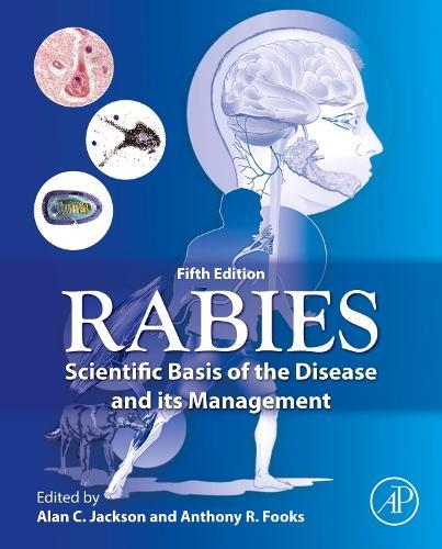 Rabies: Scientific Basis of the Disease and Its Management