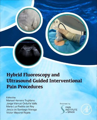 Hybrid Fluoroscopy and Ultrasound Guided Interventional Pain Procedures