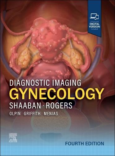 Diagnostic Imaging: Gynecology