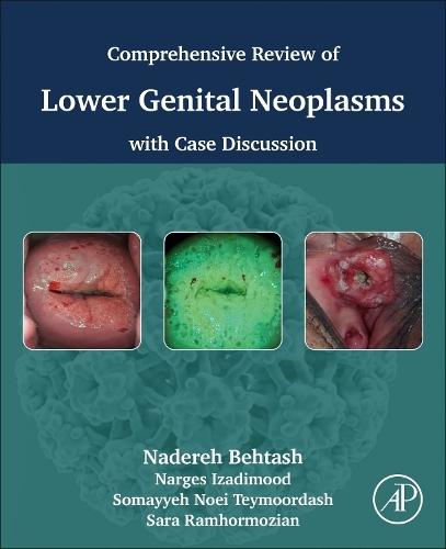 Comprehensive review of lower genital neoplasms: With case discussion