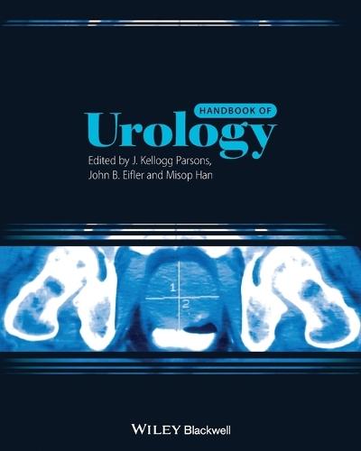 Handbook of Urology