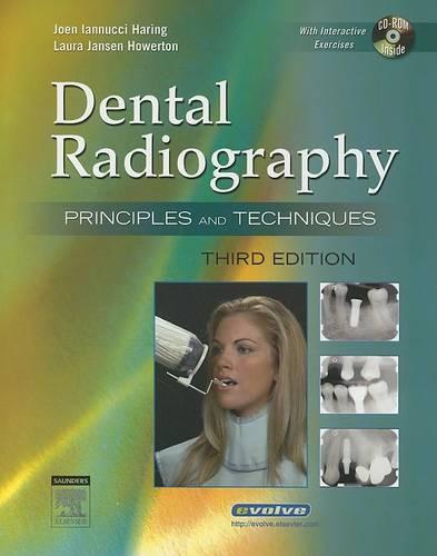Dental Radiography: Principles and Techniques