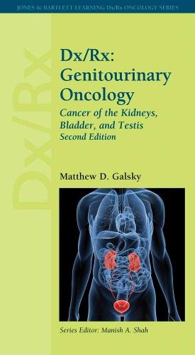 Dx/Rx: Genitourinary Oncology: Cancer of the Kidneys, Bladder, and Testis: Genitourinary Oncology: Cancer of the Kidneys, Bladder, and Testis