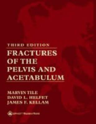 Fractures of the Pelvis and Acetabulum