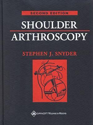 Shoulder Arthroscopy
