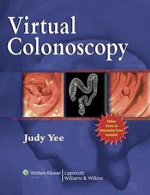 Virtual Colonoscopy
