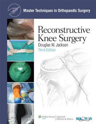Reconstructive Knee Surgery