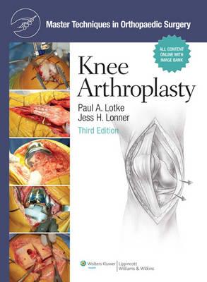 Master Techniques in Orthopaedic Surgery: Knee Arthroplasty