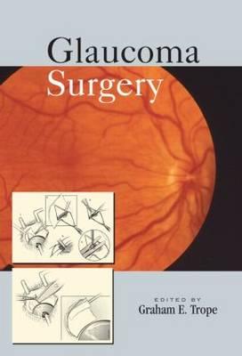 Glaucoma Surgery