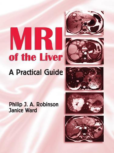 MRI of the Liver: A Practical Guide