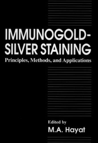 Immunogold-Silver Staining: Principles, Methods, and Applications