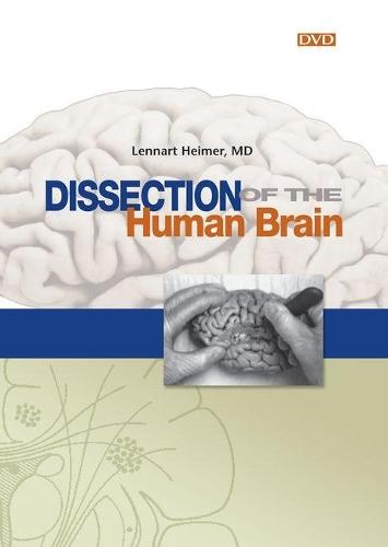 Dissection of the Human Brain