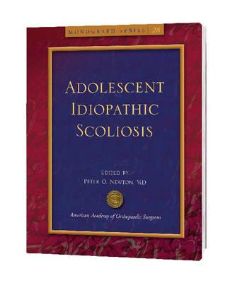 Adolescent Idiopathic Scoliosis
