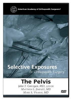 Selective Exposures in Orthopaedic Surgery: The Pelvis