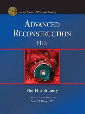 Advanced Reconstruction: Hip