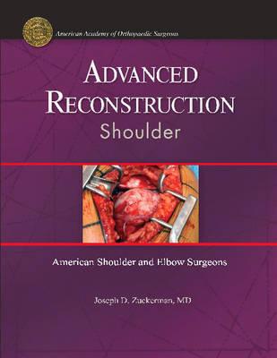 Advanced Reconstruction: Shoulder
