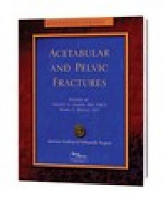 Acetabular and Pelvic Fractures