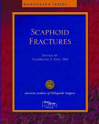 Scaphoid Fractures