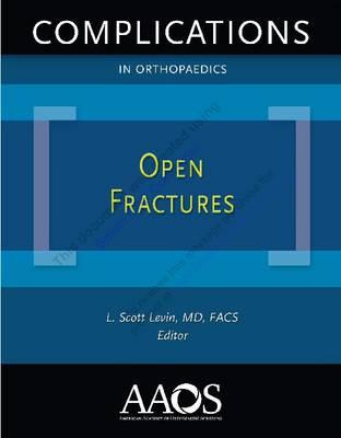 Open Fractures