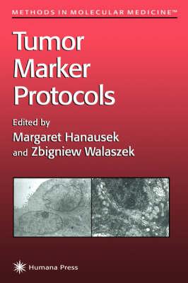 Tumor Marker Protocols