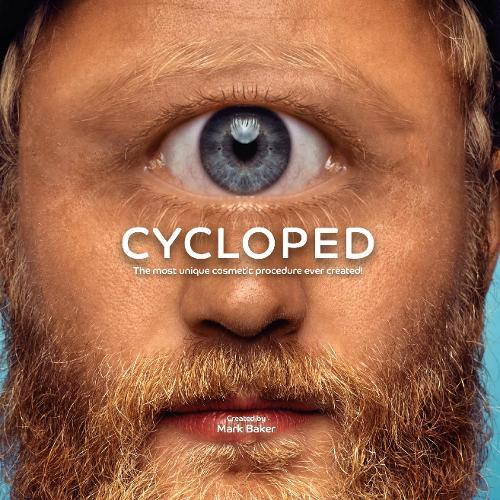 Cycloped