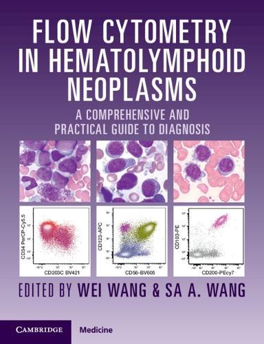 Flow Cytometry in Hematolymphoid Neoplasms: A Comprehensive and Practical Guide to Diagnosis