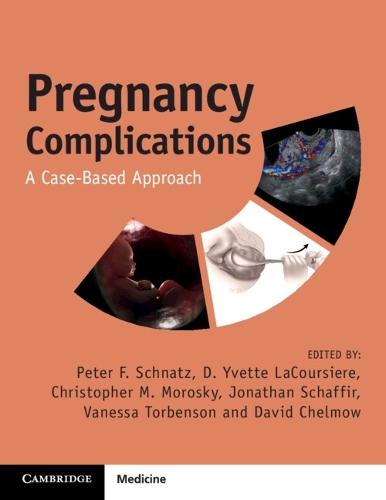 Pregnancy Complications: A Case-Based Approach