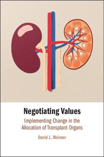 Negotiating Values: Implementing Change in the Allocation of Transplant Organs
